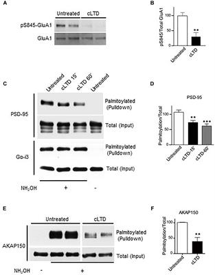 Ca2+/Calmodulin Binding to PSD-95 Downregulates Its Palmitoylation and AMPARs in Long-Term Depression